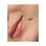 لیپگلاس ادُر - تصویر 8